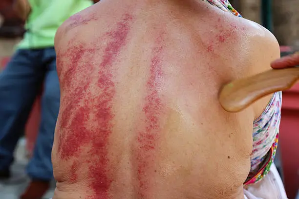 gua sha dos